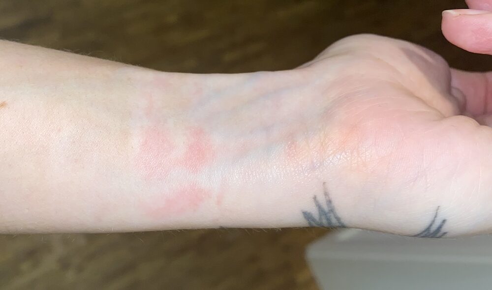 Huawei Fit 4 Pro Allergie